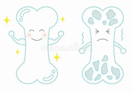 سلامت استخوان در کودکان 